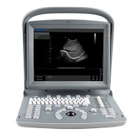 Appareil à ultrasons portatif Chison ECO1